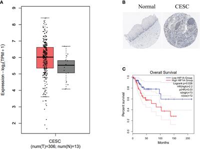 PX-478, an HIF-1α inhibitor, impairs mesoCAR T cell antitumor function in cervical cancer
